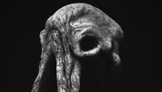 Prognostic Prognostic ile benzer